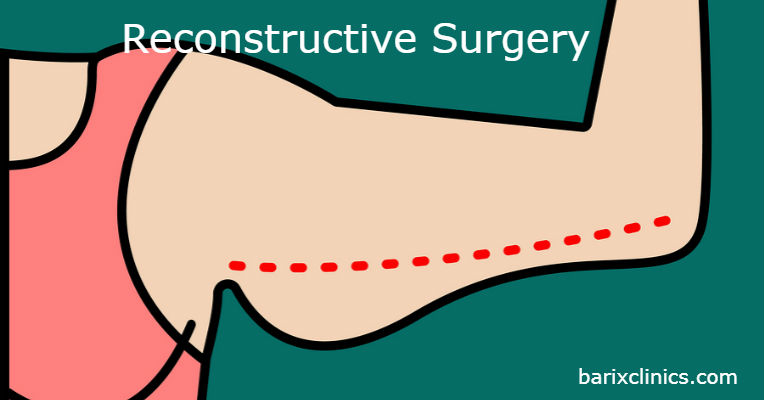 Reconstructive Surgery - Bariatric Weight Loss Surgery News and Info