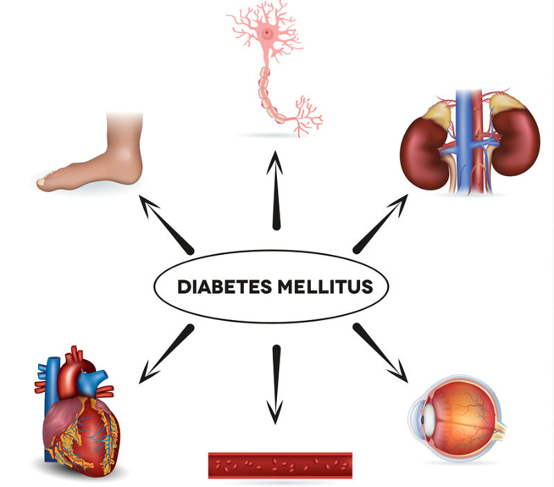 diabetes mellitus